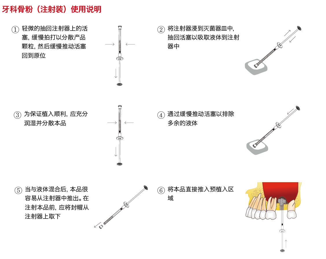 注射裝骨粉_畫(huà)板 1.png